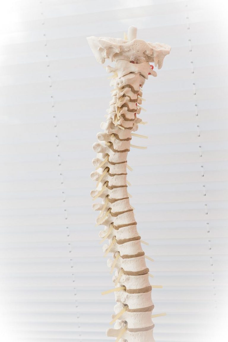 Bent spine. Column Representation